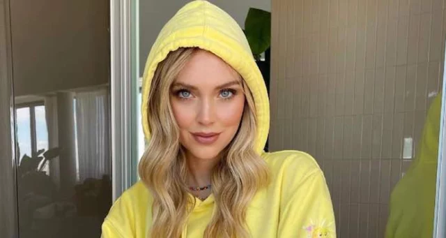 Chiara Ferragni si scotta sotto al sole: le foto dell'incidente