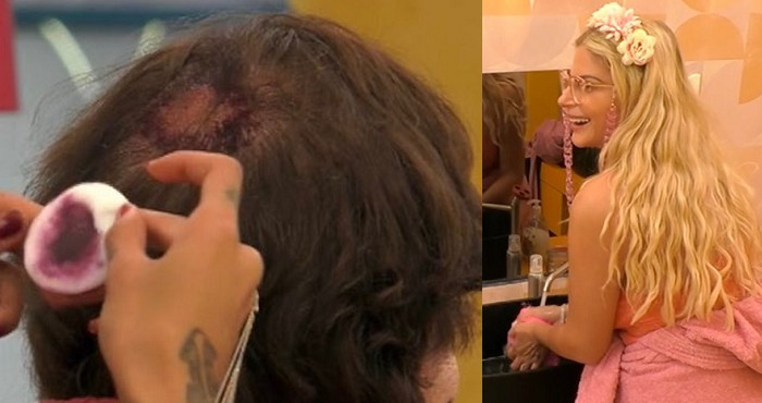 Giucas Casella Francesca Cipriani Gli Copre La Calvizie Con Lo Smalto