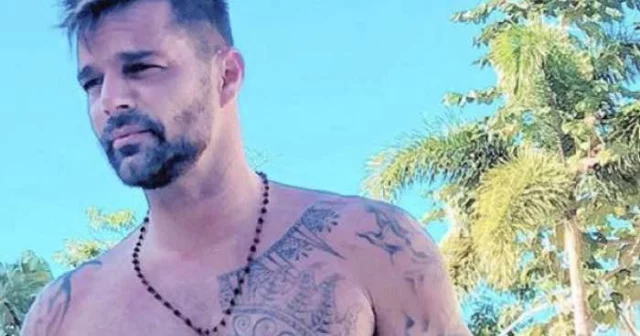Ricky Martin Ã¨ ricorso alla chirurgia estetica: le foto prima e dopo
