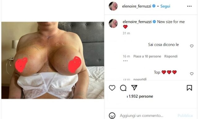 Elenoire Ferruzzi pubblica la foto del seno dopo l'intervento