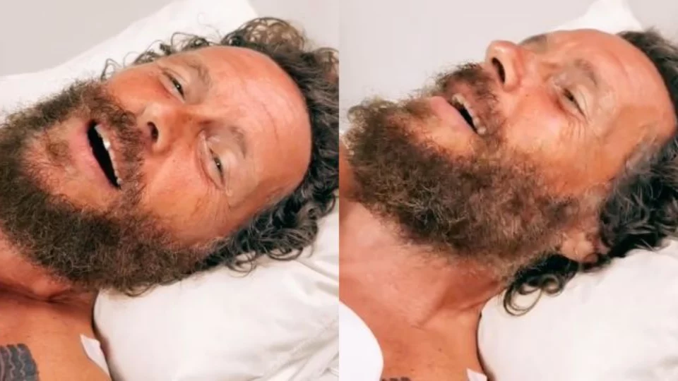 Jovanotti, incidente in bici per il cantante: femore e clavicola rotti