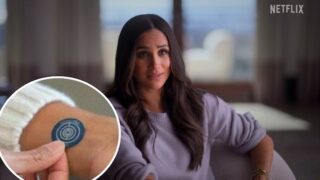 Meghan Markle, perché indossa un cerotto: ecco a cosa serve