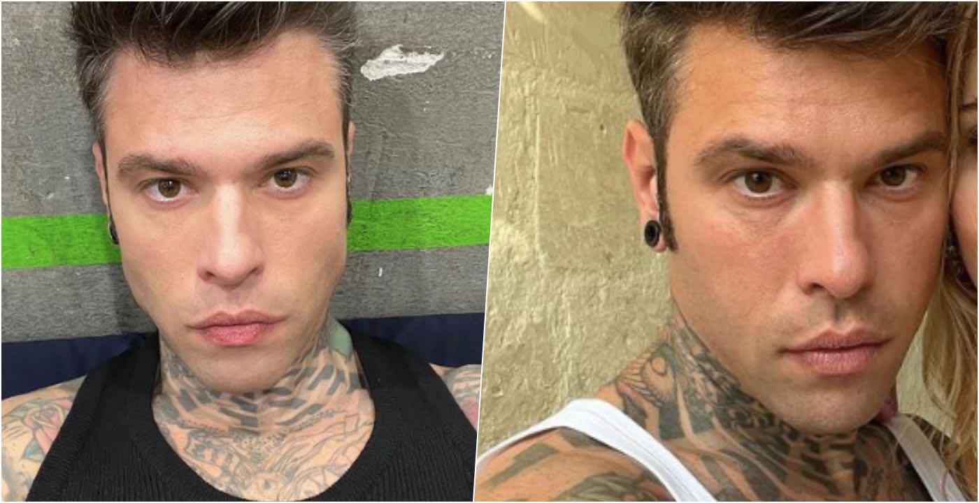 Fedez, parla il medico che l’ha operato un anno fa Fedez, parla il medico che l’ha operato un anno fa
