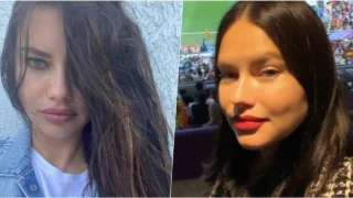 Adriana Lima, cosa è successo al volto? La modella risponde alle critiche