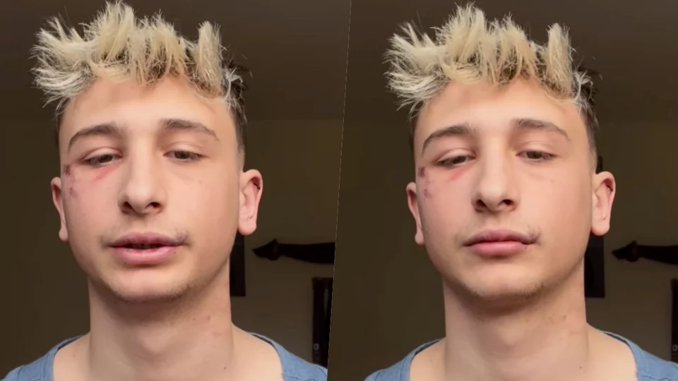 George Ciupilan è stato aggredito: il racconto