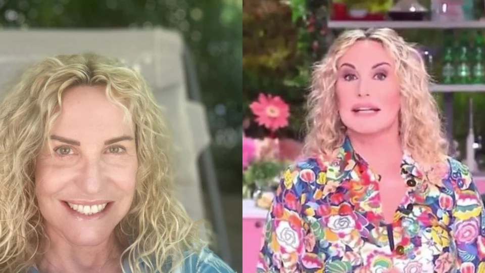 antonella clerici torna social dopo operazione