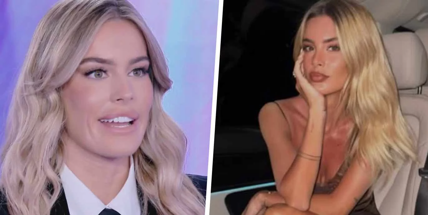 Sophie Codegoni rimuove il filler alle labbra: “Non le toccherò mai più” (VIDEO)