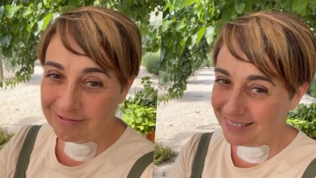 Benedetta Rossi, come sta dopo l'intervento alla tiroide