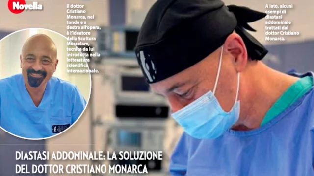 Diastasi addominale, la soluzione del Dottor Cristiano Monarca se l’addome cambia e riduce il benessere psicofisico