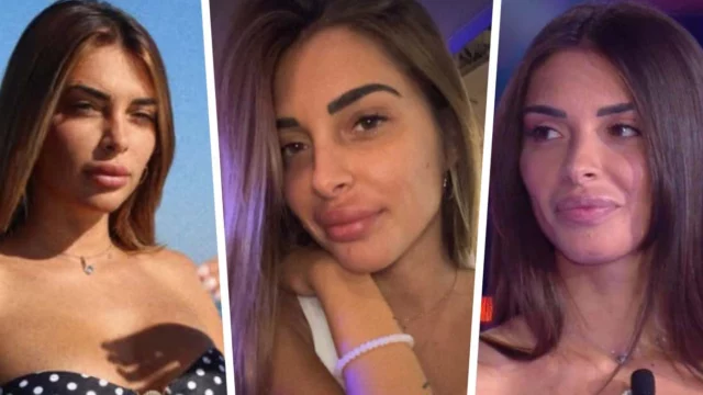 Greta Rossetti rimuove il filler alle labbra: i motivi di questa scelta