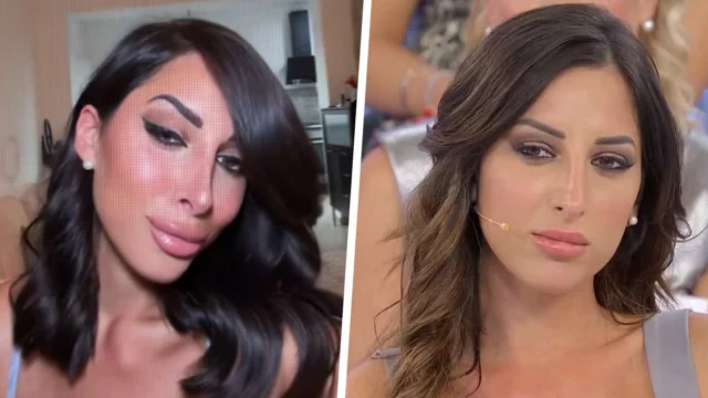 Francesca Sorrentino sbotta a chi l'accusa di essersi rifatta